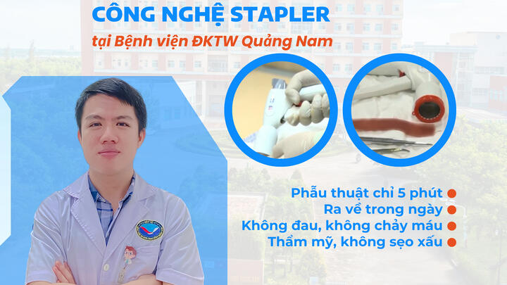 Cắt B.Q.Đ thẩm mỹ bằng công nghệ Stapler tại Bệnh viện ĐKTW Quảng Nam