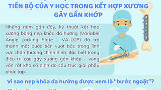 Infographic – Ứng dụng nẹp khóa đa hướng – Tiến bộ của y học trong kết hợp xương gãy gần khớp