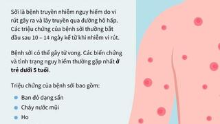 Mùa dịch Bệnh sởi – Những điều phụ huynh cần biết để bảo vệ con trẻ