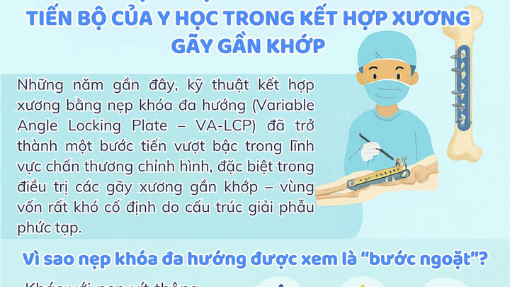 Infographic – Ứng dụng nẹp khóa đa hướng – Tiến bộ của y học trong kết hợp xương gãy gần khớp