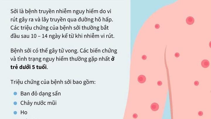 Mùa dịch Bệnh sởi – Những điều phụ huynh cần biết để bảo vệ con trẻ